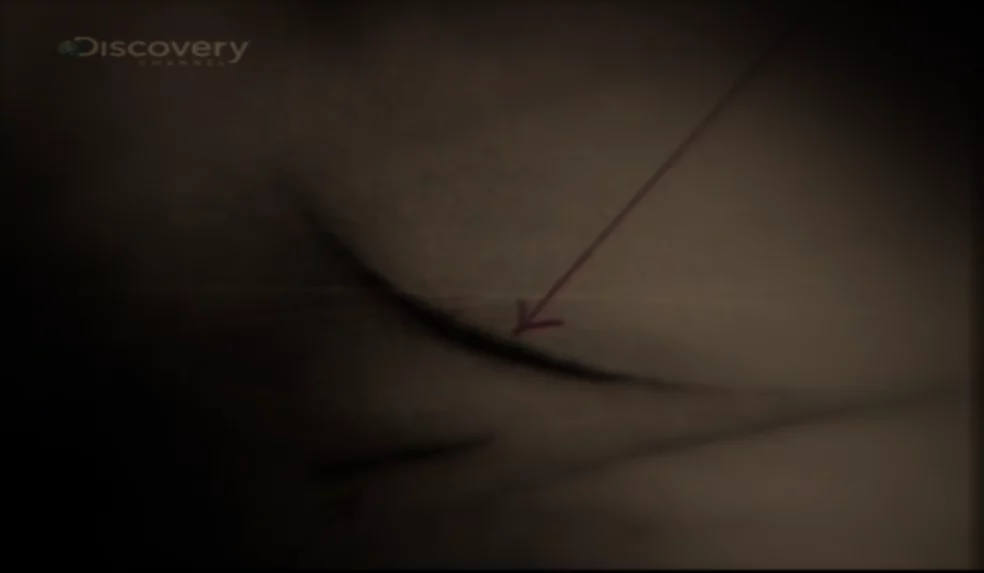 Ślad po śmiertelnym ciosie nożem (screenshot - Discovery/YouTube)