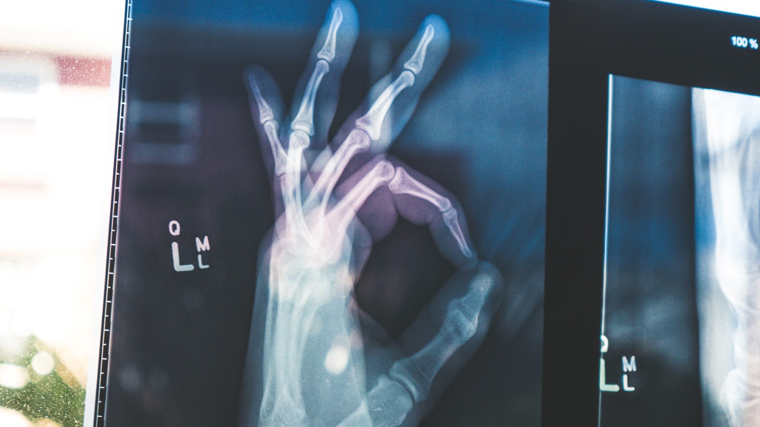 Kiedy przysługuje świadczenie rehabilitacyjne?